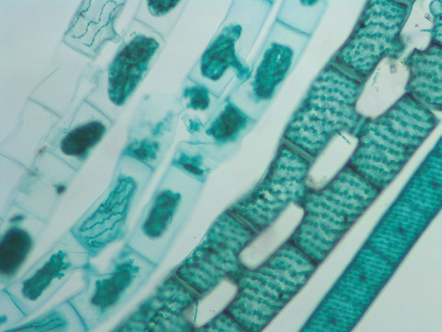 Spirogyra Slides - Spirogyra 01 100X